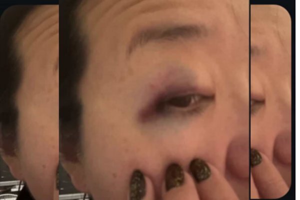 Agressão sofrida por corredora no Ibirapuera provoca onda de denúncias